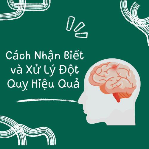 Cách Nhận Biết và Xử Lý Đột Quỵ Hiệu Quả